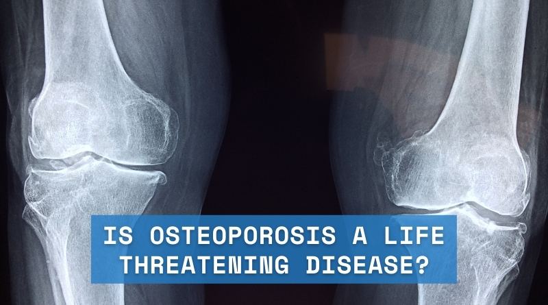 Is Osteoporosis a Life Threatening Disease